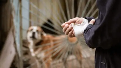 What to Do If You Have Nerve Damage from a Dog Bite