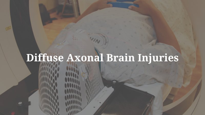 Diffuse Axonal Brain Injuries